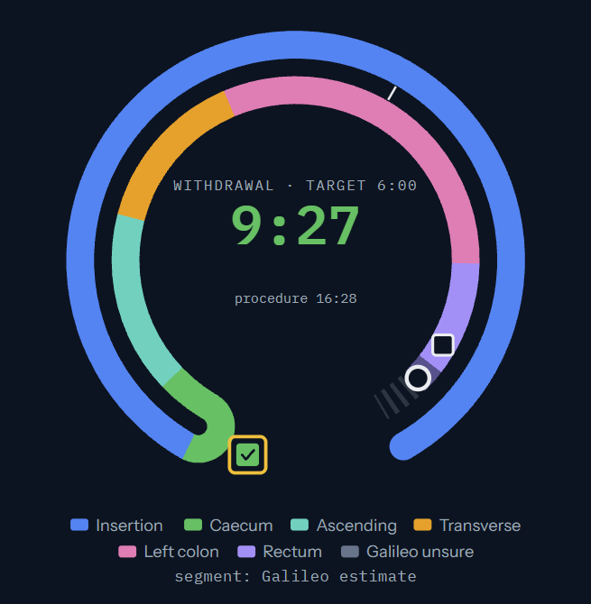 Galileo procedure dial: withdrawal time against target, landmarks reached